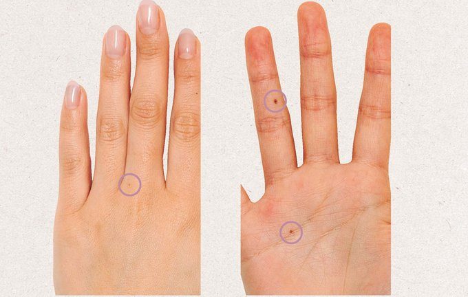 右手薬指のホクロはモテる証 ホクロや指に潜む意外な 意味 Ananニュース マガジンハウス