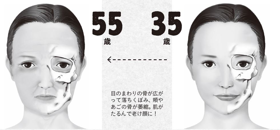 骨密度の低さは顔にも影響する シワを生む 顔の骨やせ とは Ananニュース マガジンハウス
