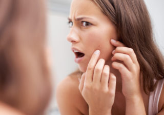 5月の肌トラブル対策…この時期急増！「肌荒れ&小じわ」原因と治し方