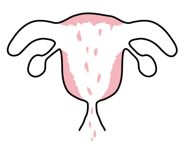 子宮イメージ