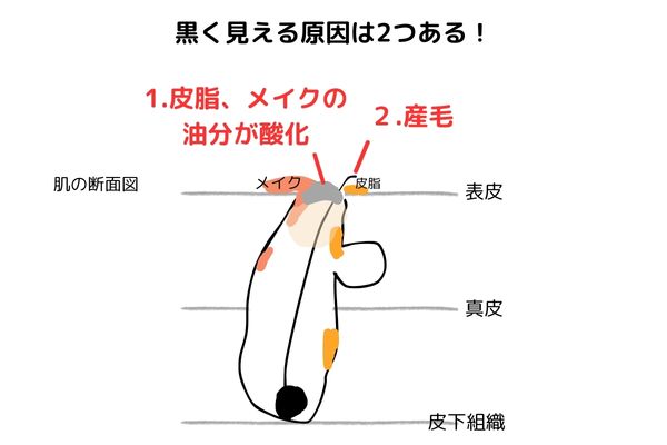 毛穴の黒ずみの原因